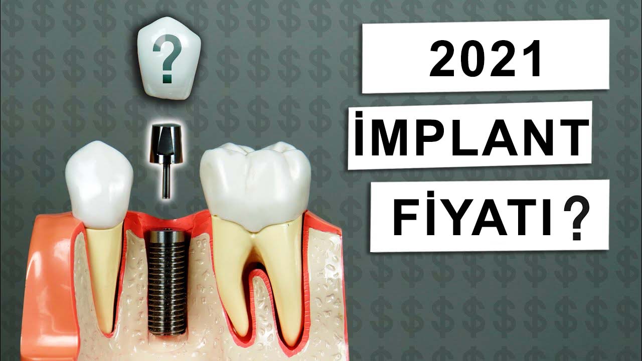 2021 implant fiyatlari